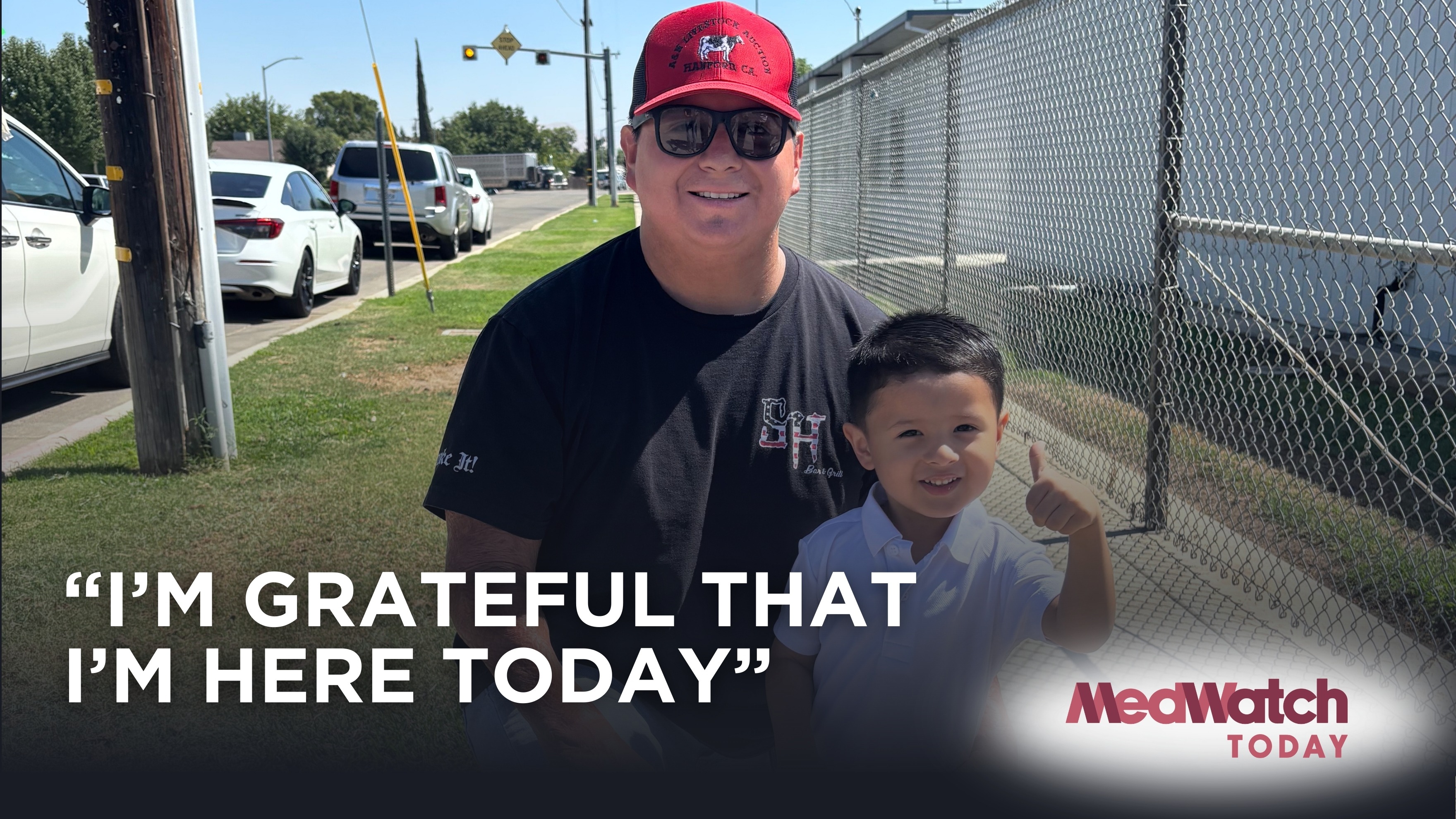 Young Father Recovers from Severe Burn Accident