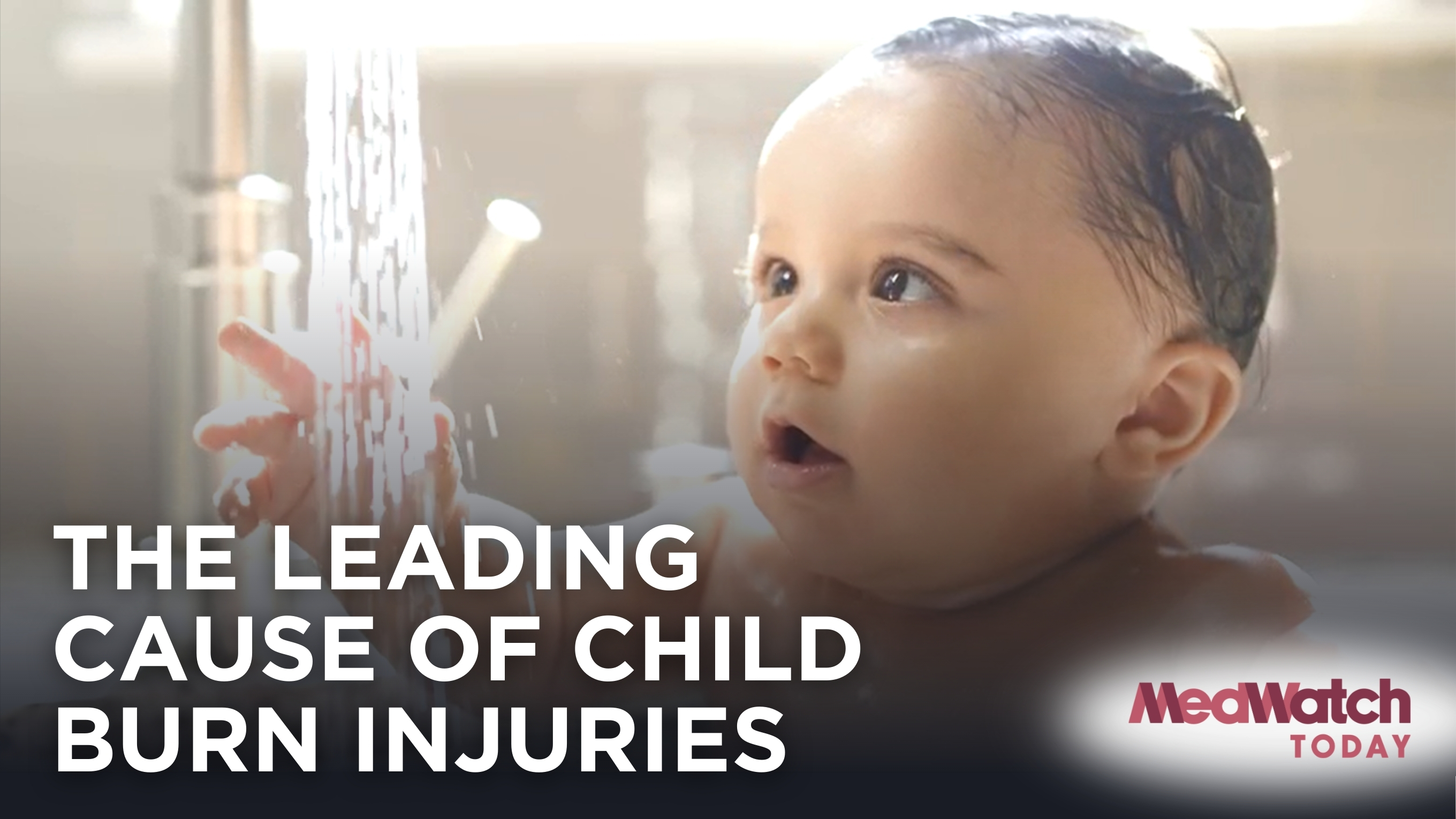 Stay Safe: Protect Your Child from Scald Burn