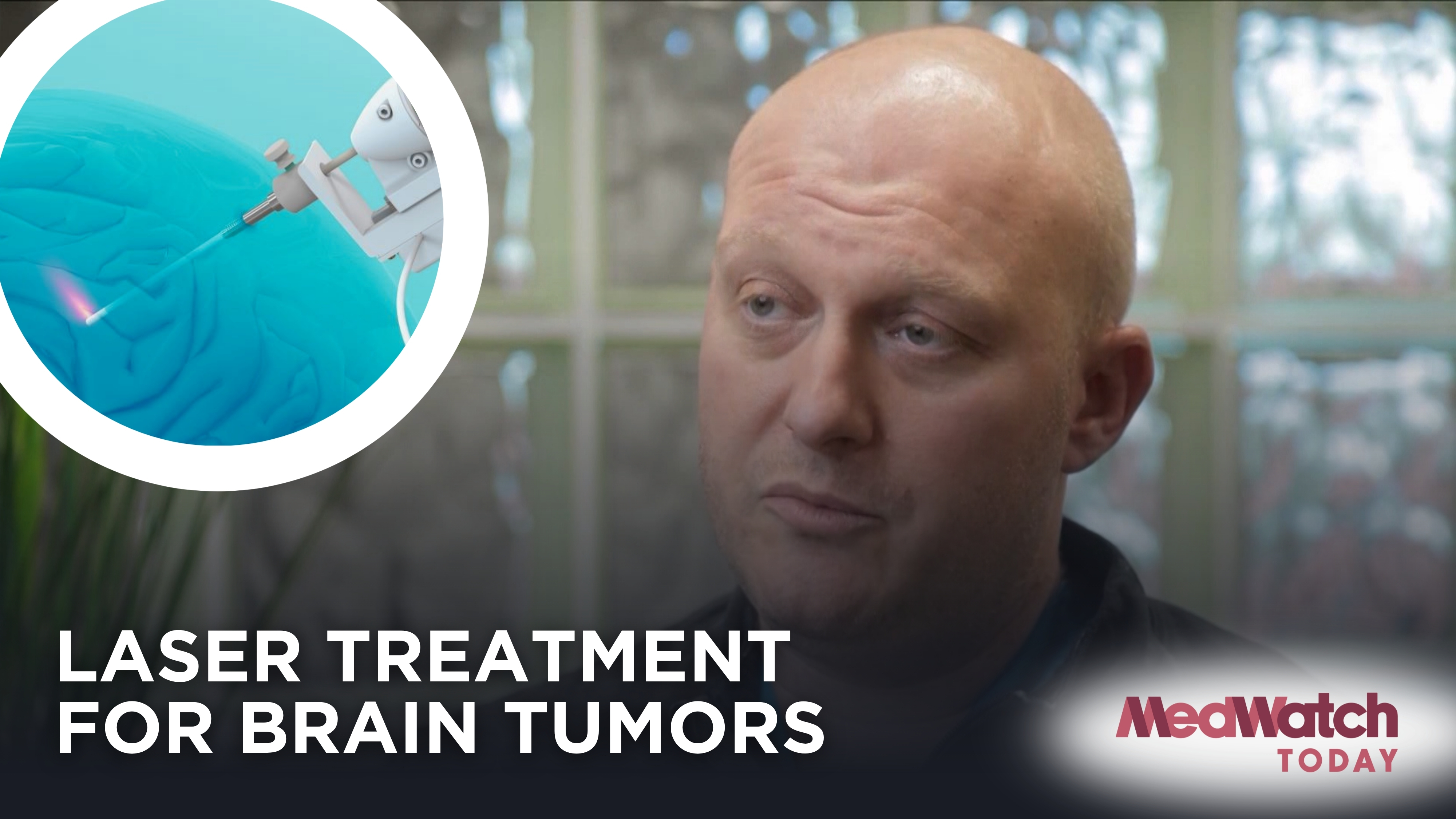  Interview of the Week: Using Lasers in Brain Surgery