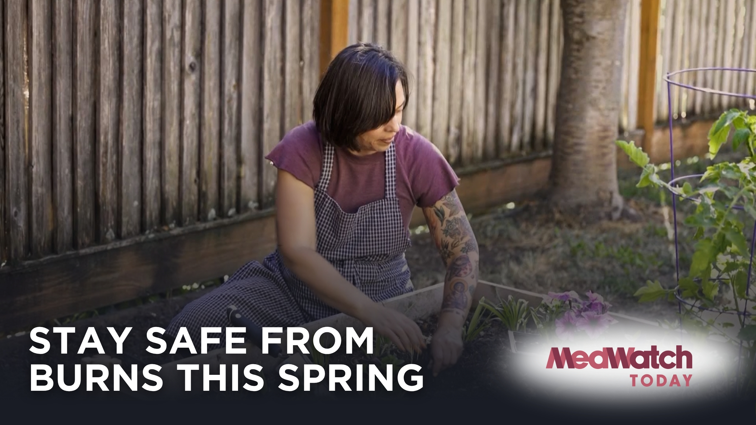  Common Spring Burn Injuries — and How to Treat Them Safely