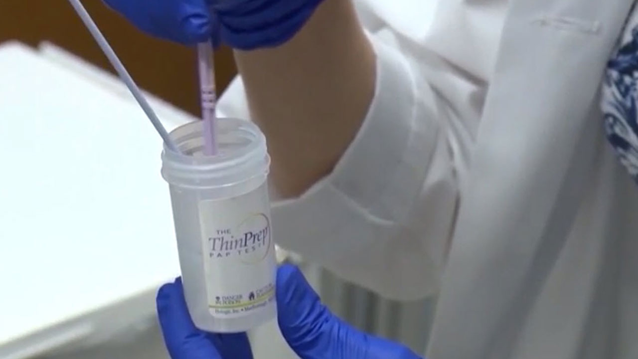 Preventing Cervical Cancer