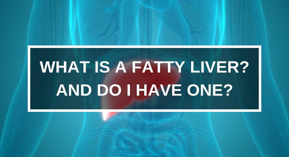 Graphic reading "What is a fatty liver? And do I have one?"