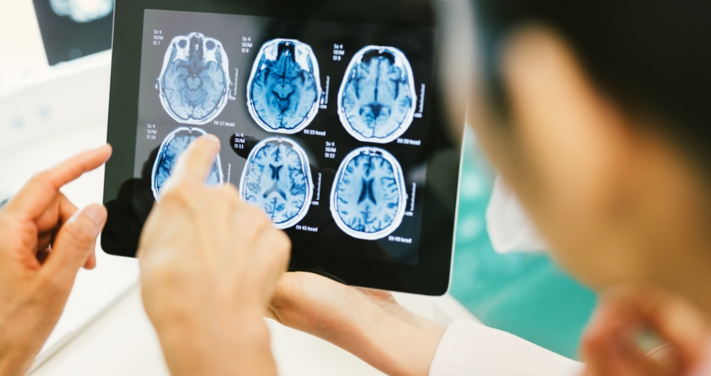 Preventing Traumatic Brain Injuries At All Ages 