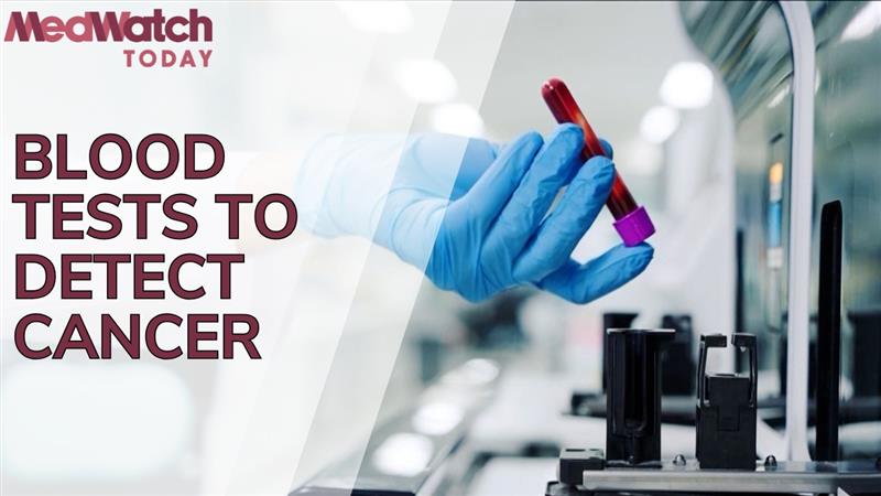Health Headline: Blood Tests to Detect Cancer