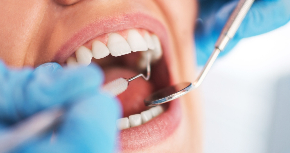 Important Health Questions to Ask Your Dentist