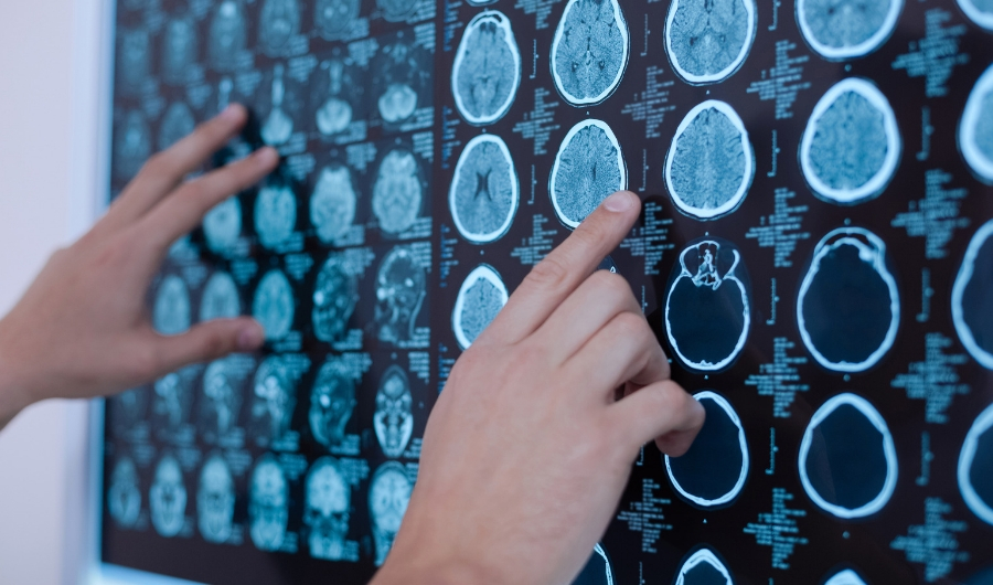 Putting all the pieces together to bring expert neuroscience care closer to home