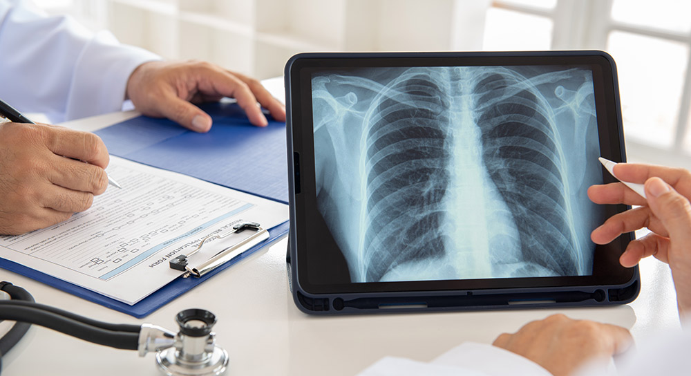 X-ray of lungs on tablet