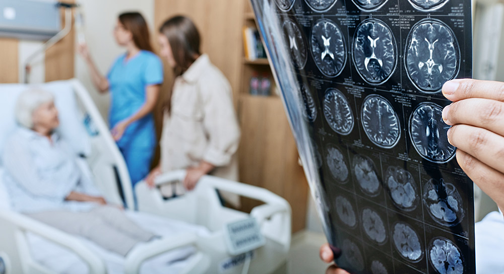 Close-up of an x-ray with brain scans. In the background, an elderly woman rests in a bed with a nurse and a female guest attending her