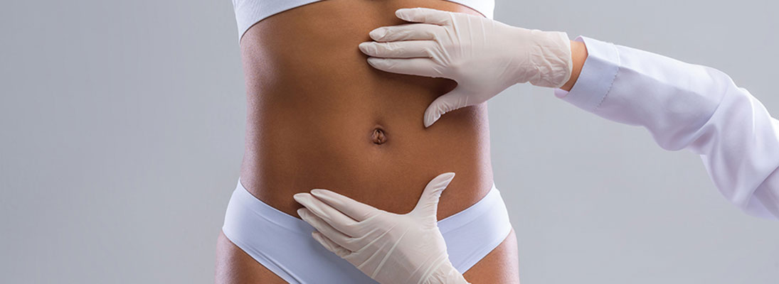 Community Medical Centers - Tummy Tuck