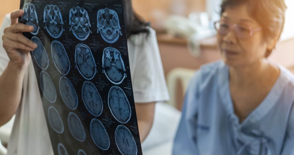 Community Regional helps other hospitals save stroke patients lives