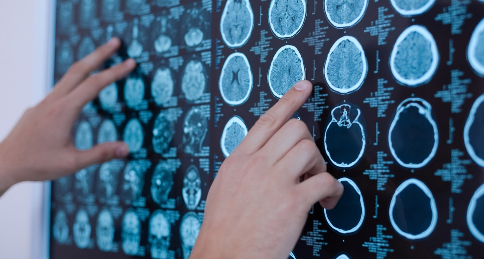 Traumatic Brain Injury: What is it? When should I seek help?