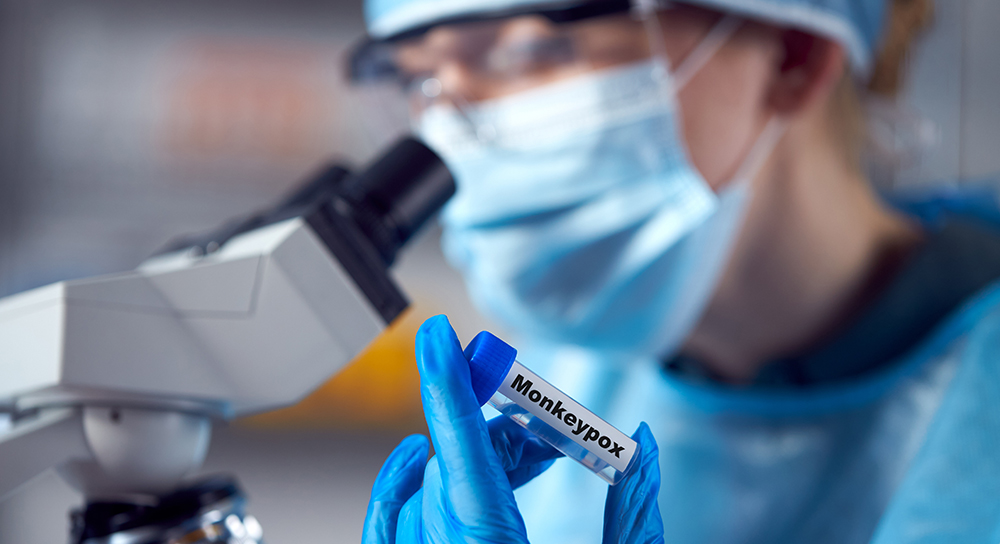 Valley doctors, residents prepare for monkeypox