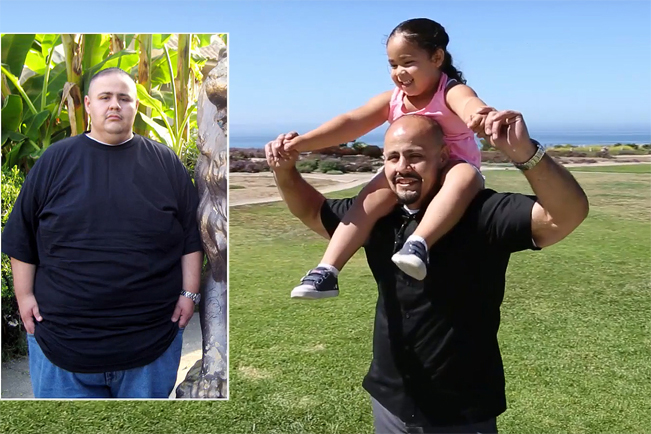 Miguel D. Garcia before and after his bariatric weight loss surgery