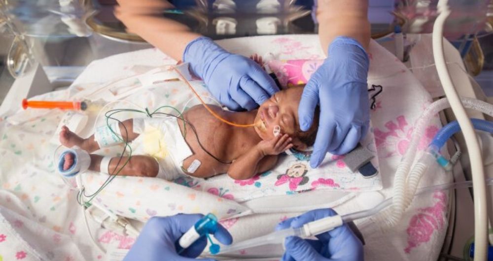 Respiratory practices help preemies stay off ventilators, breathe better for life